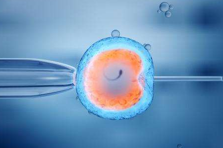 培养箱